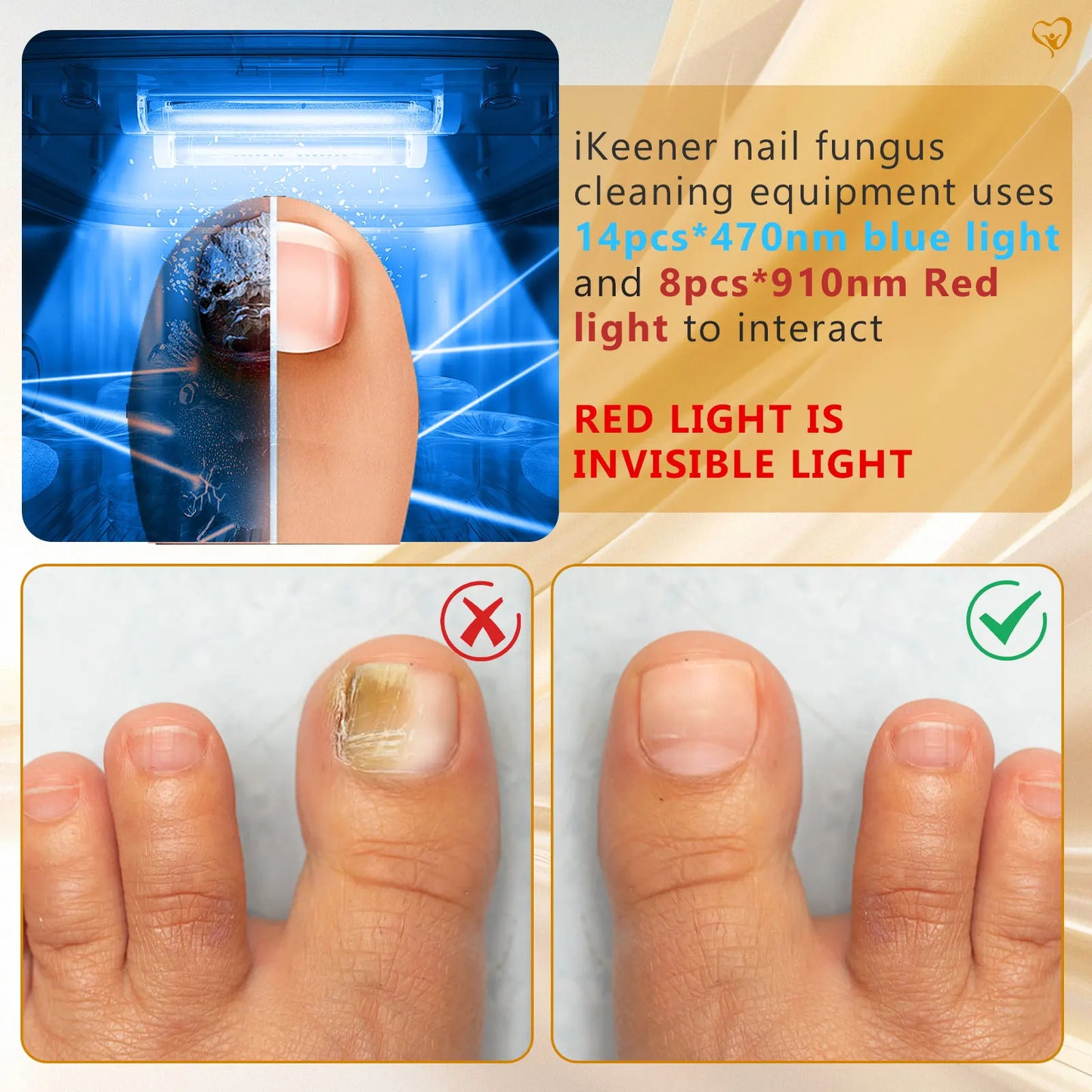 Say Goodbye to Nail Fungus! πβ¨ Try our Wireless 45W Laser Device for Fast & Effective Toenail Care! π #NailHealth #FungusFree